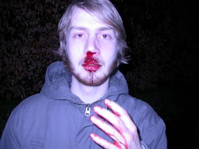 Nase-kapott.jpg